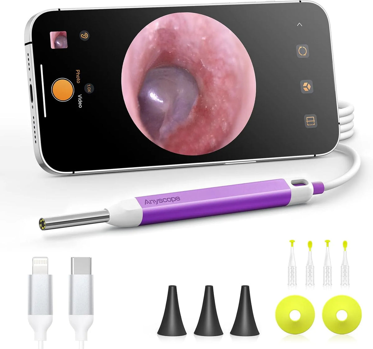 HD-Ohrkamera, Android OS, schmal, Digitales, Digitales Otoskop mit Gyroskop